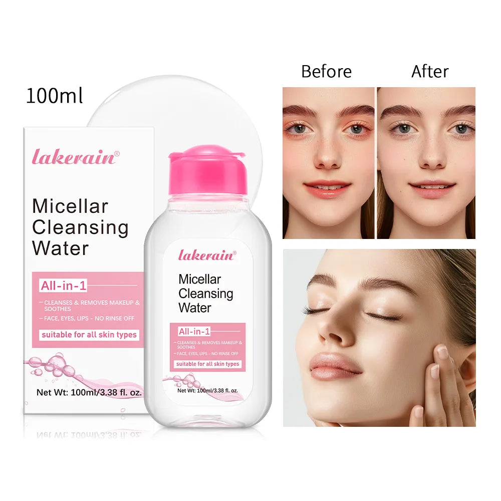 Micellar Water — Gentle Makeup Remover for Face & Eyes