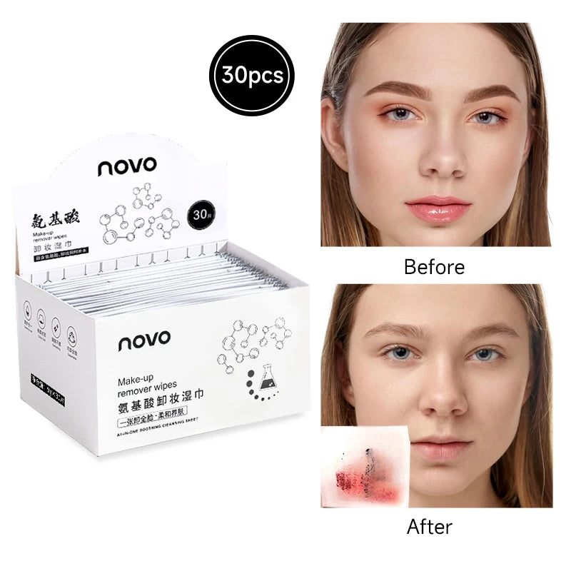 Gentle Makeup Remover Wipes (30 Pack) — Melts Away a Long Day