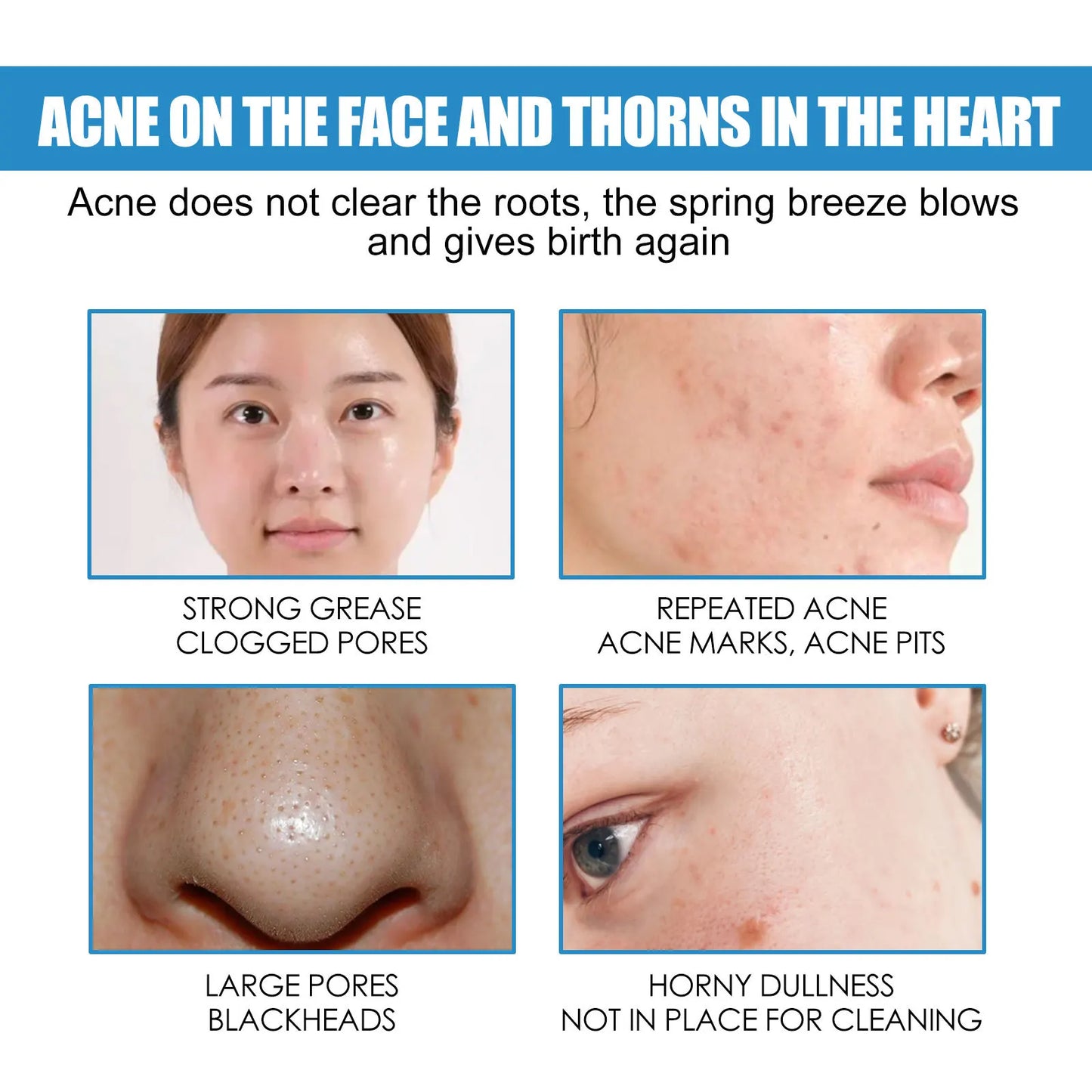 Centella Asiatica Repair Cream — Hydrates, Refines Pores & Soothes Skin