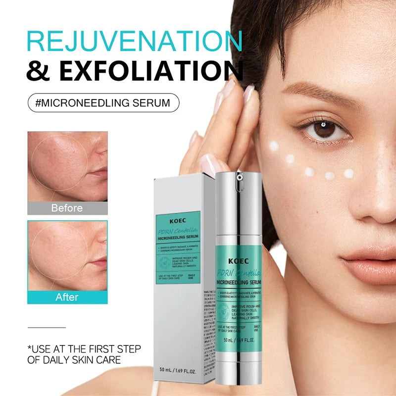 Spicule Microneedling Serum — Korean Glass Skin Treatment