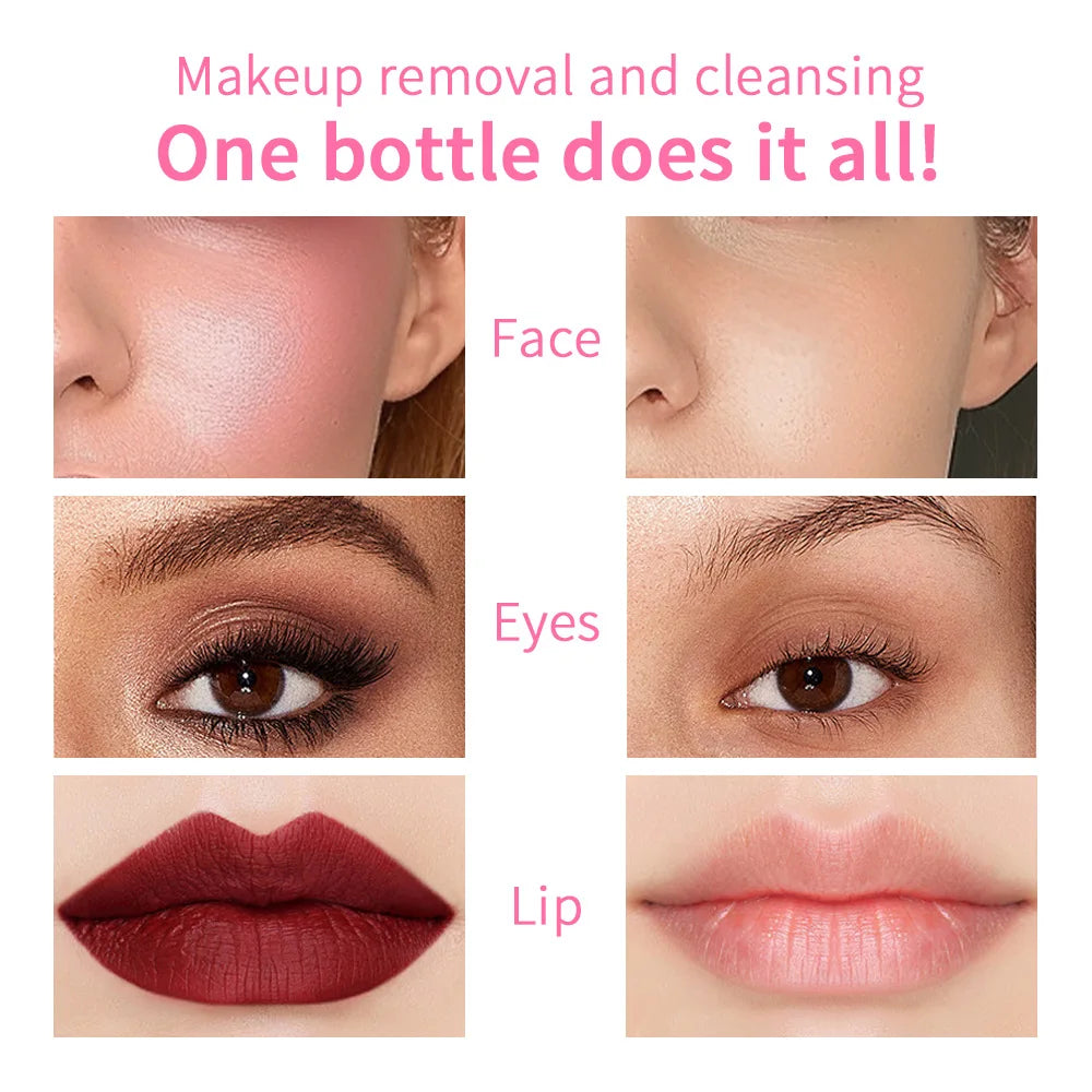 Micellar Water — Gentle Makeup Remover for Face & Eyes