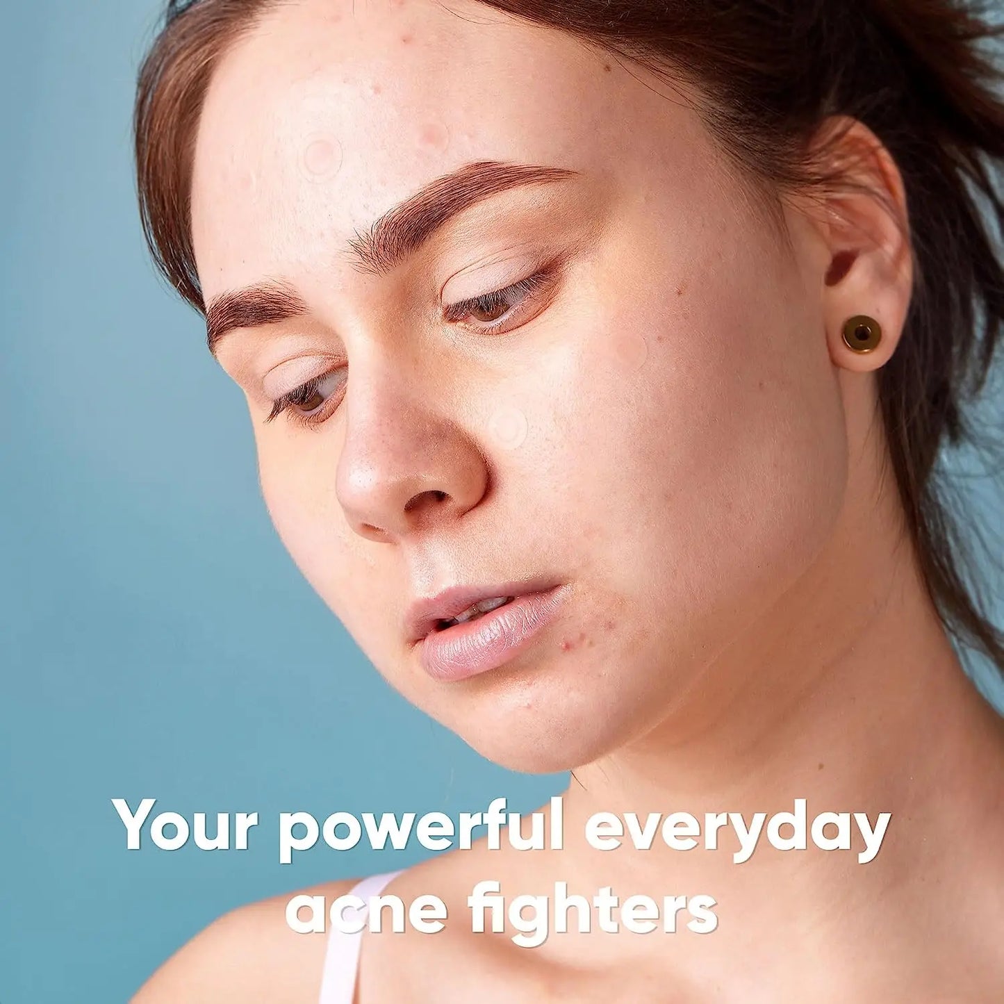 Hydrocolloid Acne Patches — Cover Blemishes & Speed Up Healing