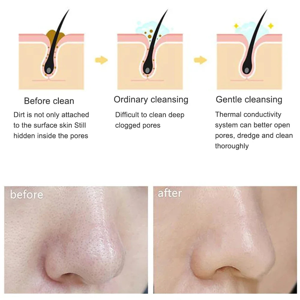 Electric Sonic Facial Cleansing Brush — Deep Clean, Waterproof