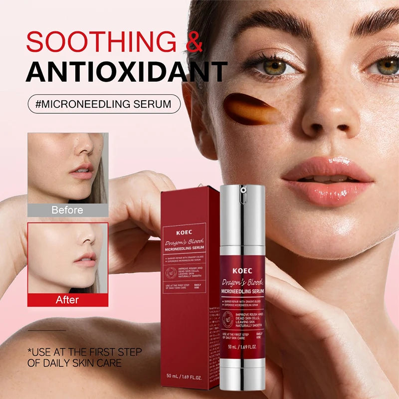 Spicule Microneedling Serum — Korean Glass Skin Treatment
