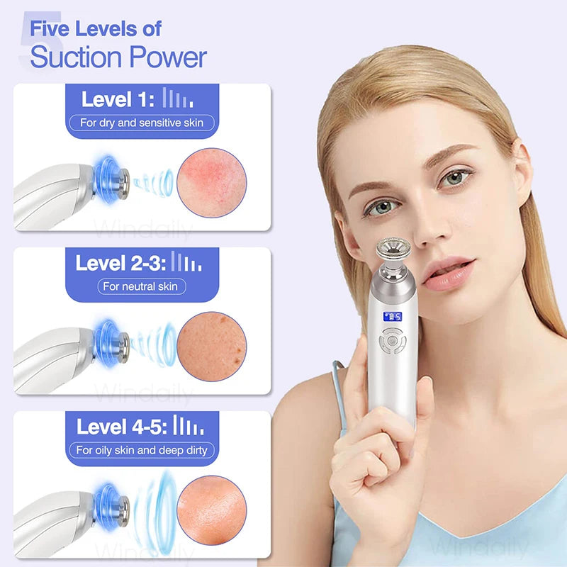 Diamond Microdermabrasion Machine — Clears Blackheads & Refines Pores