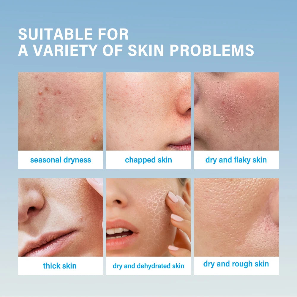 Barrier-Restoring Moisture Cream — Comfort That Lasts